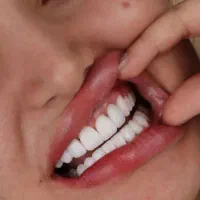 کامپوزیت با وام 4%