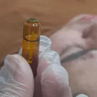 فیشال تخصصی پوست/بیش از سه سال سابقه درمان