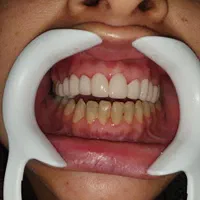 خدمات دندانپزشکی برلیان|خدمات آرایشگری و زیبایی|بانه, |دیوار