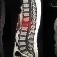 پرداخت هزینه جراحی دیسک کمر ( 10 نفر)