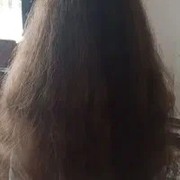 فروش مو