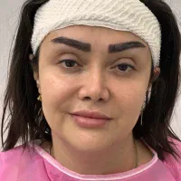 کاشت ابرو و مو با تیم تخصصی در کلینیک معتبر|خدمات آرایشگری و زیبایی|رشت, بوسار|دیوار