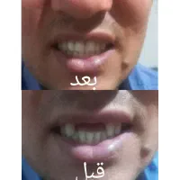 دندان سازی امانی|آرایشی، بهداشتی، درمانی|گنبد کاووس, |دیوار