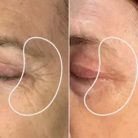 کرم ضد چین و چروک گاتیو(۵ کاره)|آرایشی، بهداشتی، درمانی|مراغه, |دیوار