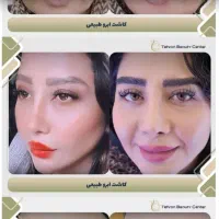 تور جراحی زیبایی قسطی|خدمات آرایشگری و زیبایی|کیش, |دیوار