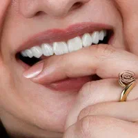 جشنواره کامپوزیت لمینیت روکش عصب ونیر بریدج ترمیم|خدمات آرایشگری و زیبایی|تهران, هفت حوض|دیوار