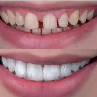 نیازمند دندانپزشک عمومی خانم یا آقا