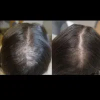 موهای شماضعیف شده یادچارریزش موشده اید|خدمات زیبایی و سلامت|تبریز, |دیوار