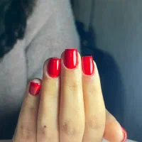 تخفیف ماهانه کاشت ۴۰۰ترمیم ۲۰۰ژلیش ۱۵۰