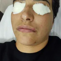 پاکسازی و فیشال ۵۰٪ تخفیف«مشاوره رایگان، خ بزرگمهر|خدمات آرایشگری و زیبایی|اصفهان, چشمه باقرخان|دیوار