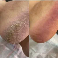 فقط۲۹۹تومان/آموزش مجازی پدیکور صفرتا صد
