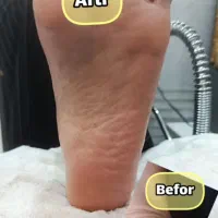 انجام کف سابی و اسپا