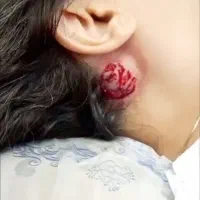 انواع حجامت ، زالو درمانی ، بادکش|خدمات آرایشگری و زیبایی|پرند, فاز ۵|دیوار