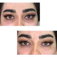 تزریق ژل سی سی 600|خدمات آرایشگری و زیبایی|پیشوا, |دیوار