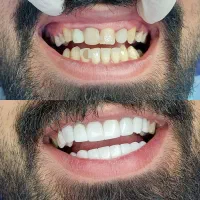 کامپوزیت زیبایی|خدمات آرایشگری و زیبایی|اسلامشهر, شهرک قائمیه|دیوار