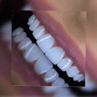 دندانپزشکی *لمینت*کامپوزیت*ایمپلنت*بیلیچینگ|خدمات آرایشگری و زیبایی|مشهد, احمدآباد|دیوار