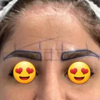 کاشت مو وابروتخصصی