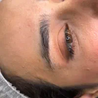میکروبلیدینگ به سبک نچرال فیبروز