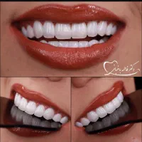 دندانپزشکی نگارام|خدمات آرایشگری و زیبایی|قم, بکایی|دیوار