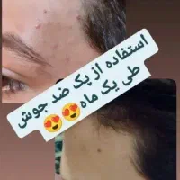 دعوت به مشاوره رایگان|آرایشی، بهداشتی، درمانی|شیراز, ابیوردی|دیوار