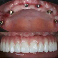 خدمات دندانپزشکی (بانرخ تامین اجتماعی )|خدمات آرایشگری و زیبایی|تبریز, |دیوار