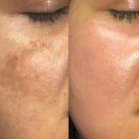 با لک هات خدافظی کن