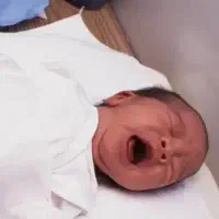 ختنه اطفال بدون درد و خون ریزی