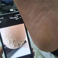 پدیکور درمانی آقایان و بانوان|خدمات آرایشگری و زیبایی|قم, دورشهر|دیوار