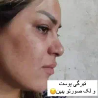 کرم معجزه شب|آرایشی، بهداشتی، درمانی|گنبد کاووس, |دیوار