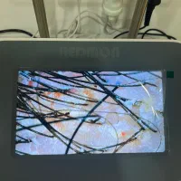 پاکسازی پوست سر،پروتئین تراپی، اوزون تراپی|خدمات آرایشگری و زیبایی|رشت, فلسطین|دیوار