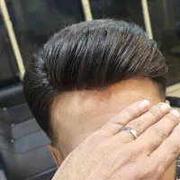 پروتز مو|خدمات آرایشگری و زیبایی|دزفول, |دیوار