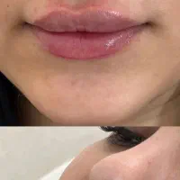 مطب زیبایی