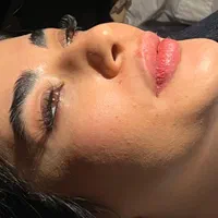 تخفیفات استثنایی ژل و بوتاکس در مطب زیبایی|خدمات آرایشگری و زیبایی|قم, زنبیل آباد|دیوار