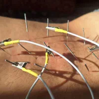 ارائه کلیه خدمات طب سنتی در منزل در سنندج