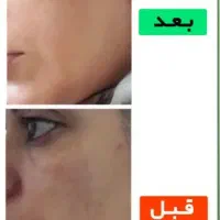 روغن تراپی|آرایشی، بهداشتی، درمانی|نهبندان, |دیوار