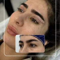 جشنواره بلفارو پلاستی کاشت ابرو ساکشن غبغب لیپوفیس