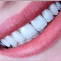 دندانسازی(تخصصی)احسان دندان مصنوعی،دندان سازی،