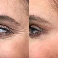 فشیال تخصصی و درمان مشکلات پوستی