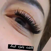 کاشت مژه هیدن