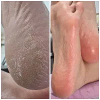 پدیکور درمانی آقایان در کلینیک پوست دریکجلسه|خدمات آرایشگری و زیبایی|پردیس, فاز ۲|دیوار