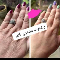 کرم وی ای پی اصل صدرصد تضمینی سفیدکننده قوی|حراج|یاسوج, |دیوار