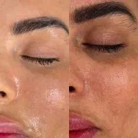 پاکسازی و جوانسازی پوست|خدمات آرایشگری و زیبایی|ورزنه, |دیوار