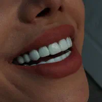 تخفیف ویژه کامپوزیت + اقساط