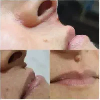 خالبرداری و پی ار پی