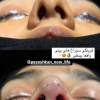 بینی بدون نقص با بهترین جراح متخصص گوش و حلق|خدمات آرایشگری و زیبایی|تهران, دروس|دیوار