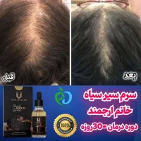 نمایندگی رسمی لاکچری کوین سرم سیرسیاه رویش مجددمو