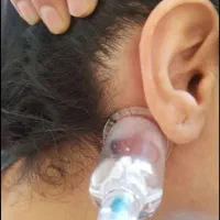 ماساژ تخصصی
