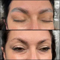 لیزر پاک کردن تاتو۵۰۰/روشن سازی/لک خالبرداری