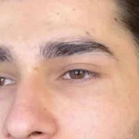 رفع تیرگی لب ،شیدینگ لب ،اسکالپ موی سر آقایون|خدمات آرایشگری و زیبایی|زاهدان, |دیوار