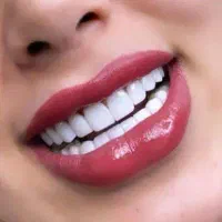 خدمات کامپوزیت،روکش،دندان مصنوعی|خدمات آرایشگری و زیبایی|چهاردانگه (تهران), |دیوار